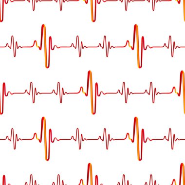Soyut kardiyogramların kusursuz deseni