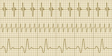 Elektrokardiyogram, seamless modeli
