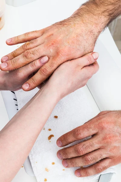 Mãos de massagem masculina — Fotografia de Stock