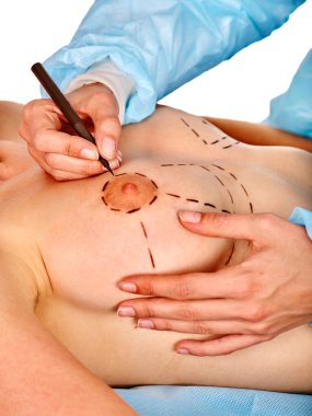 Doktor noktalı çizgi üzerinde kadın meme yapıyor. .