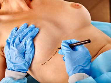 Doktor noktalı çizgi üzerinde kadın meme yapıyor. .