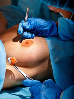 Cerrah kadın göğüsleri çalışır .