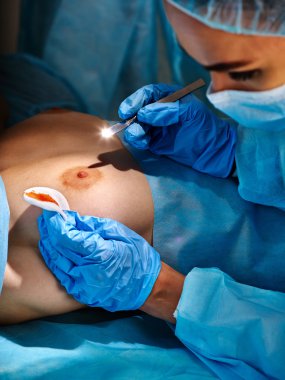 Cerrah, kadınların göğüslerini çalıştırmadan önce ameliyat aletlerini çalıştırMaya devam ediyor .