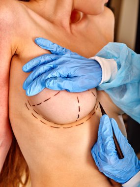 Doktor noktalı çizgi üzerinde kadın meme yapıyor. .