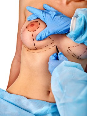 Doktor noktalı çizgi üzerinde kadın meme yapıyor. .