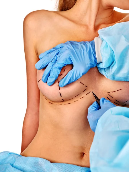 Arts maakt stippellijn op vrouwelijke borst . — Stockfoto