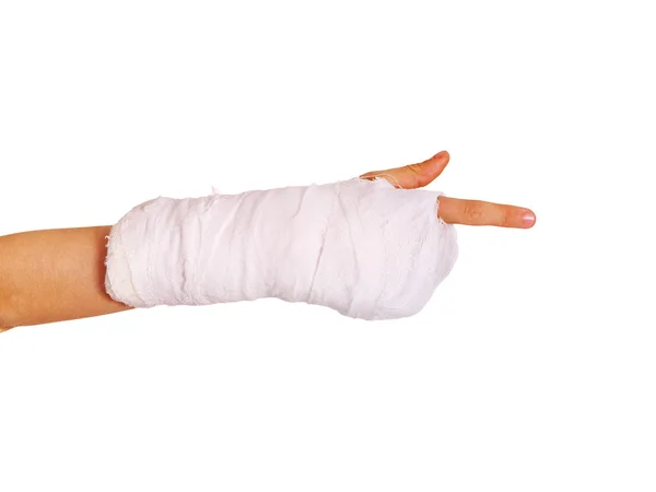 Gebroken kind hand — Stockfoto