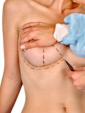 Doktor noktalı çizgi üzerinde kadın meme yapıyor. .