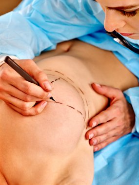 Doktor noktalı çizgi üzerinde meme yapıyor.