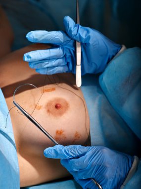 Cerrah kadın göğüsleri çalışır