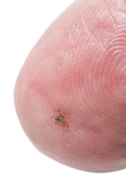 Tiny deer tick on finger tip of man — Stock Photo, Image