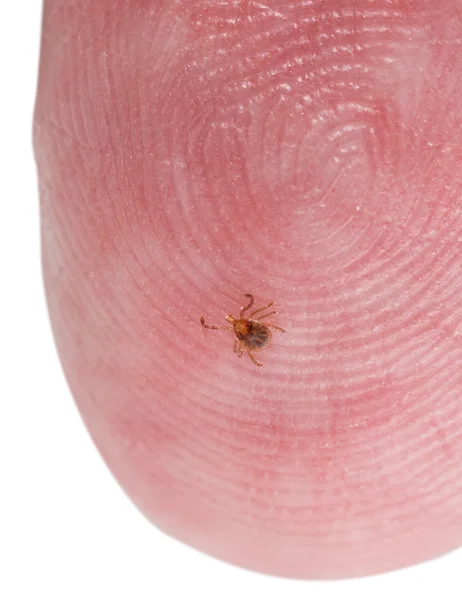 Tiny deer tick on finger tip of man — Stock Photo, Image