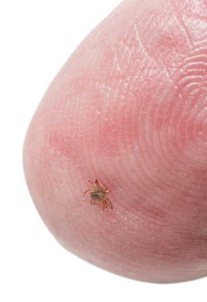 Tiny deer tick on finger tip of man Royalty Free Stock Images