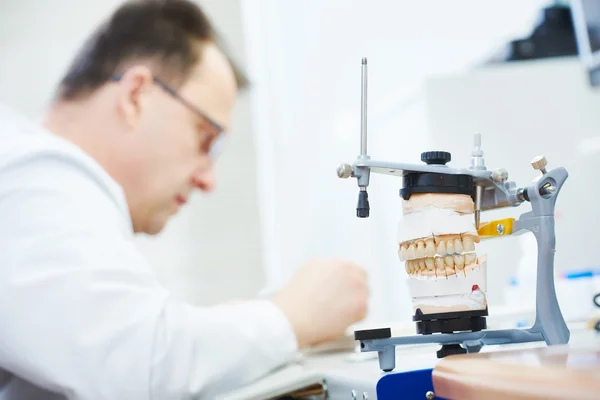 Próteses dentárias — Fotografia de Stock