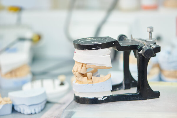 Articulator with dental prosthesis model