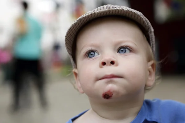 Toddler with a wound on his chin — Stock Photo, Image