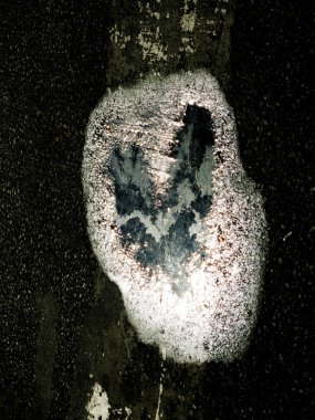 kalp şeklinde birikintisi