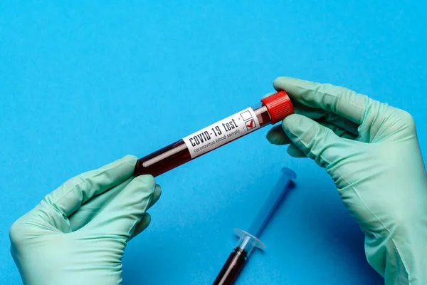 Assistente técnico de laboratório ou médico segurando uma amostra de sangue em tubo de ensaio — Fotografia de Stock