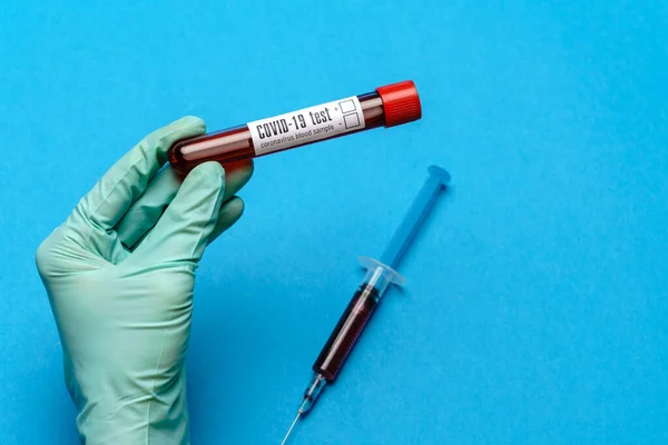 Assistente técnico de laboratório ou médico segurando uma amostra de sangue em tubo de ensaio — Fotografia de Stock