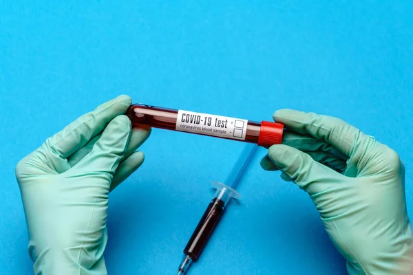 Assistente técnico de laboratório ou médico segurando uma amostra de sangue em tubo de ensaio — Fotografia de Stock