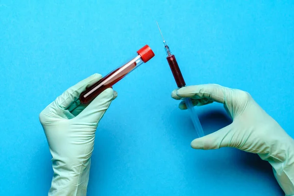 Assistente técnico de laboratório ou médico segurando uma amostra de sangue em tubo de ensaio — Fotografia de Stock