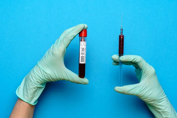 Laboratorium technicus assistent of arts met een bloedmonster in reageerbuis — Stockfoto