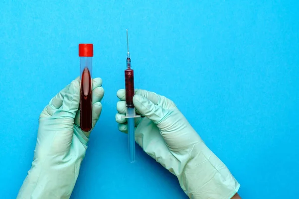 Asistente técnico del laboratorio o médico que sostiene una muestra de sangre en un tubo de ensayo — Foto de Stock