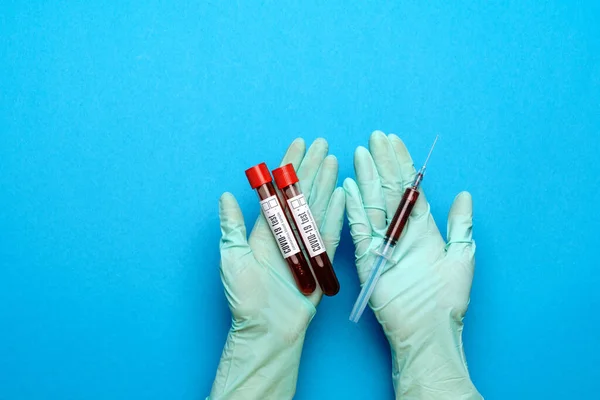 Laboratorium technicus assistent of arts met een bloedmonster in reageerbuis — Stockfoto