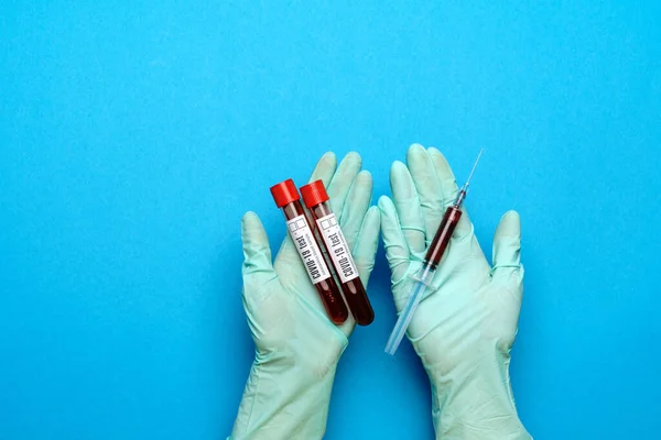 Assistente técnico de laboratório ou médico segurando uma amostra de sangue em tubo de ensaio — Fotografia de Stock