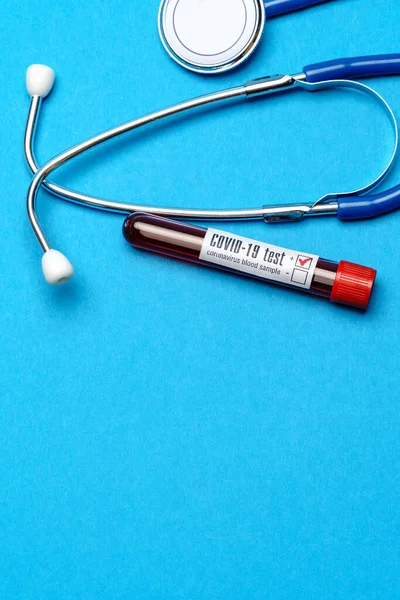 파란색 배경의 의료 장비 - 청진기와 시험관 - 건강 관리 및 의학 개념 — 스톡 사진