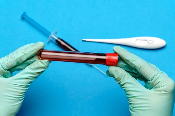 Βοηθός τεχνικού εργαστηρίου ή ιατρός που κρατά δείγμα αίματος σε δοκιμαστικό σωλήνα — Φωτογραφία Αρχείου