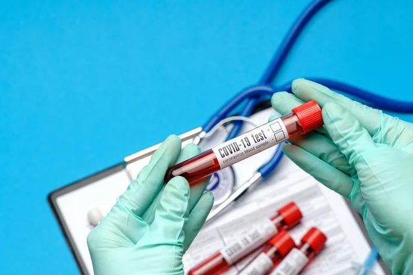 Assistente técnico de laboratório ou médico vestindo luvas de borracha ou látex segurando tubo de teste de sangue sobre prancheta com formulário em branco — Fotografia de Stock