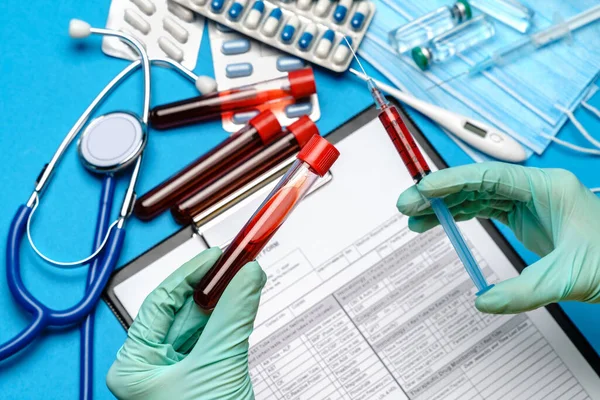 피검사 튜브를 빈 형태로 클립보드 위에 들고 있는 고무장갑이나 유액 장갑을 끼고 있는 의사나 실험실의 기술자 보조원 — 스톡 사진