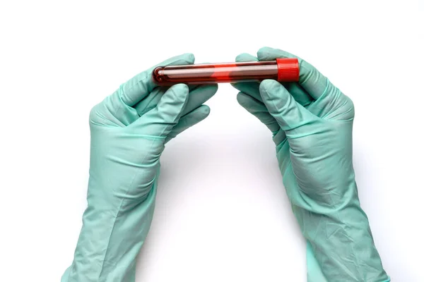 흰 배경에 분리되어 있는 시험관에서 혈액 샘플을 들고 있는 라텍스 장갑을 끼고 있는 손 — 스톡 사진