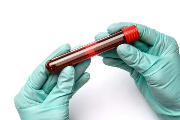 Mano en guante de látex sosteniendo la muestra de sangre en el tubo de ensayo de cerca aislado sobre fondo blanco —  Fotos de Stock