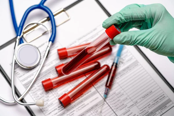 Assistente técnico de laboratório ou médico vestindo luvas de borracha ou látex segurando tubo de teste de sangue sobre prancheta com formulário em branco — Fotografia de Stock