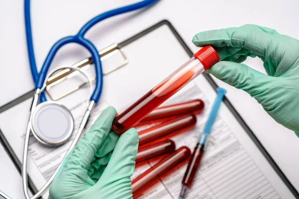 Asistente técnico de laboratorio o médico con guantes de goma o látex que sostienen el tubo de análisis de sangre sobre el portapapeles con forma en blanco — Foto de Stock