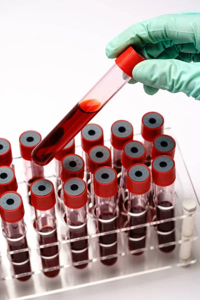 Hands of a lab technician with a test tube of blood sample and a rack with other samples over light grey background — Stockfoto