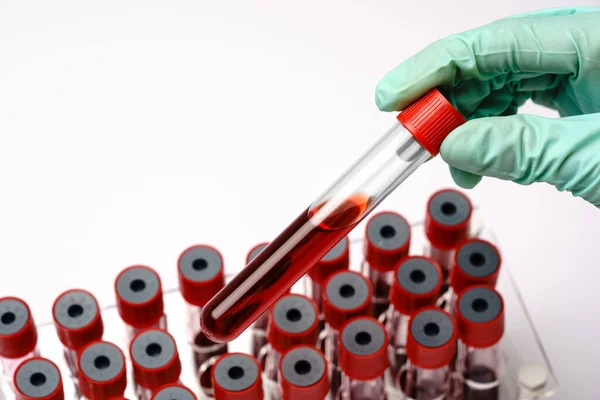 Manos de un técnico de laboratorio con un tubo de ensayo de muestra de sangre y un estante con otras muestras sobre fondo gris claro — Foto de Stock