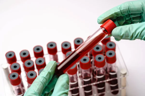 Mãos de um técnico de laboratório com um tubo de teste de amostra de sangue e um rack com outras amostras sobre fundo cinza claro — Fotografia de Stock