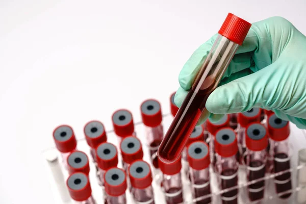 Mãos de um técnico de laboratório com um tubo de teste de amostra de sangue e um rack com outras amostras sobre fundo cinza claro — Fotografia de Stock