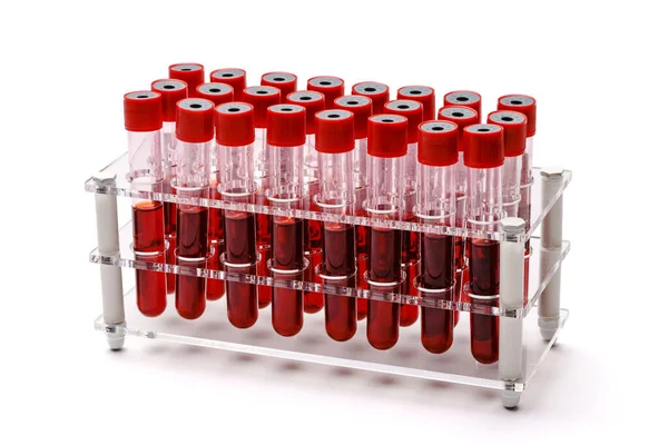 A rack of vacuum venipuncture test tubes filled with blood samples Isolated on a while background Stock Picture