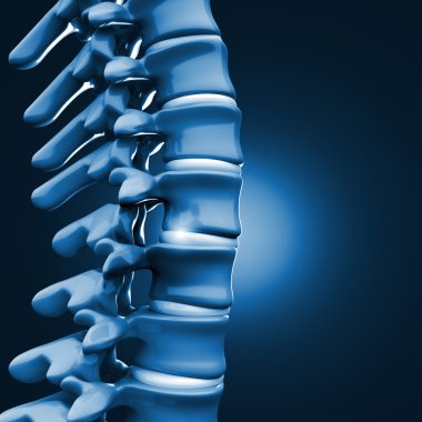 Fıtıklaşmış disk insan spinal