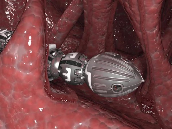 신체 내에서 로봇 외과 의사 — 스톡 사진