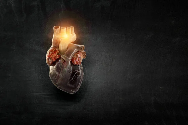 Az emberi szív képe fémelemekből — Stock Fotó
