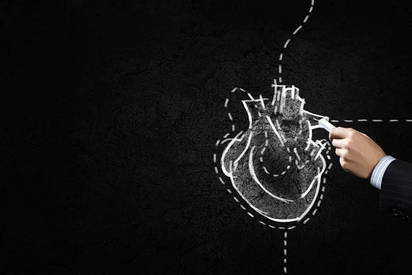 Хирургия сердца — стоковое фото