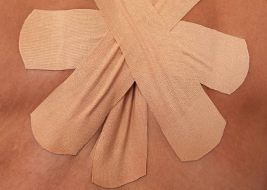 Modern alçıyla sırt ağrısı tedavisi.