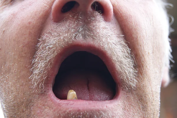 Muž s jednou zuby — Stock fotografie