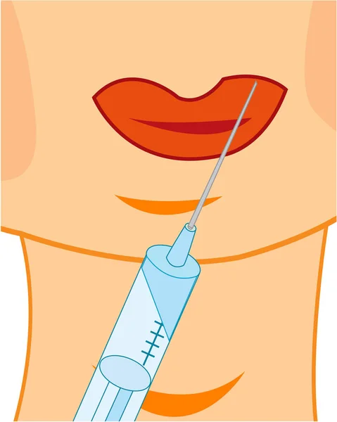 Steigern Sie die Lippen durch Botox-Verfahren — Stockvektor