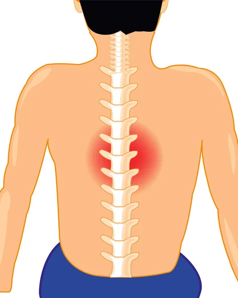 白い背景に病気の背骨を持つ男は絶縁されている — ストックベクタ